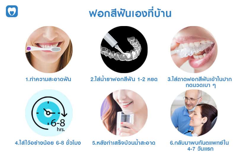 เคล็ดลับฟอกฟันขาวอย่างปลอดภัยและง่ายดาย ทำได้บ่อยๆ เลย!