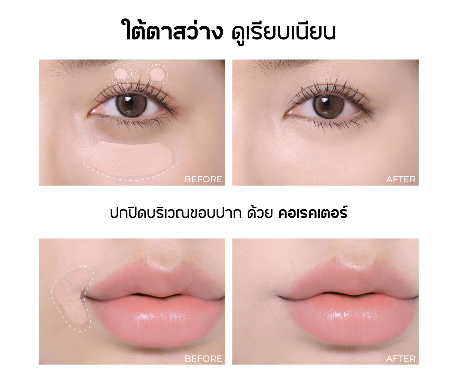 ✨ ทำไม “คอนซีลเลอร์” ถึงเป็นไอเท็มที่ขาดไม่ได้?