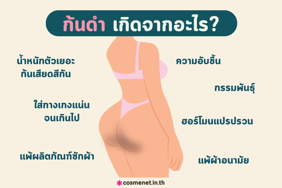 ครีมก้นดำ–ทำไมปัญหาผิวคล้ำถึงเกิดขึ้นง่ายกว่าที่คิด?