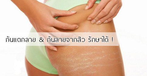 ครีมก้นดำ–ทำไมปัญหาผิวคล้ำถึงเกิดขึ้นง่ายกว่าที่คิด?