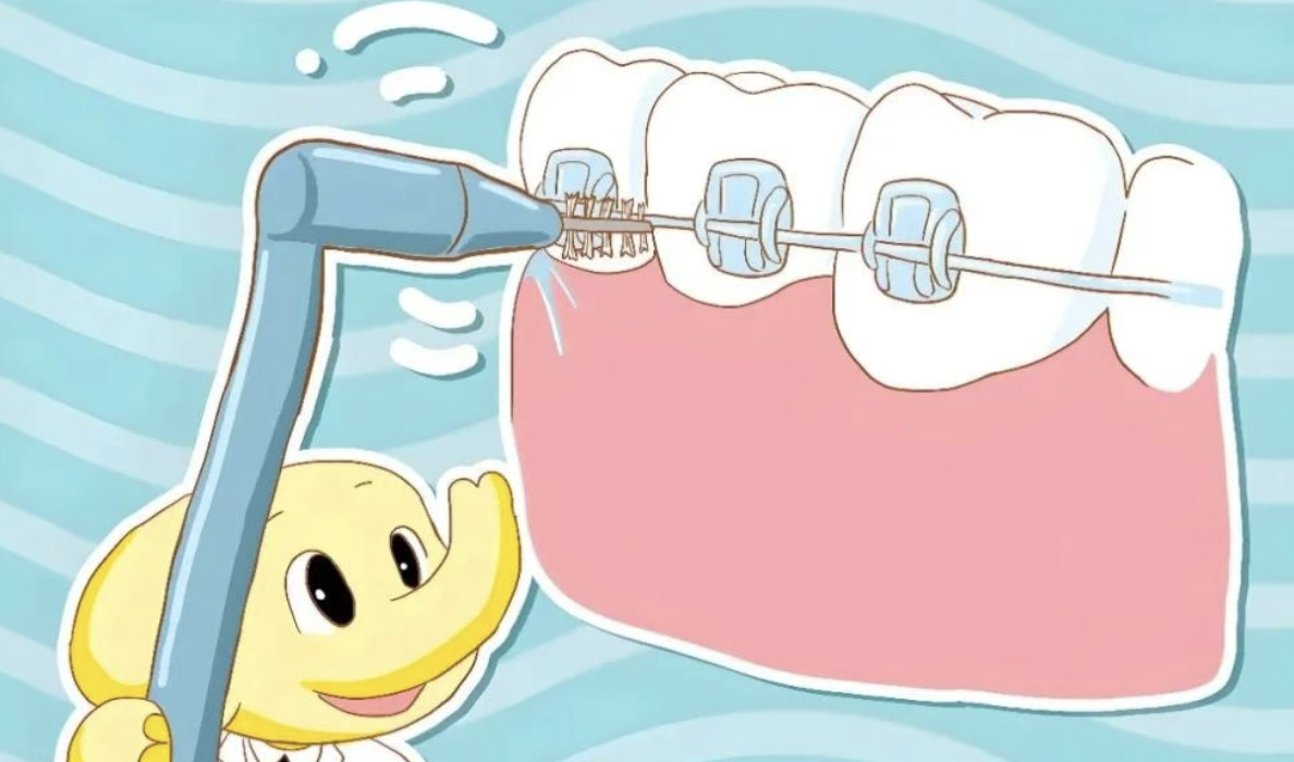 เครื่องล้างช่องปากที่แนะนำในปี 2568 : เครื่องล้างช่องปากยี่ห้อไหนดีที่สุด?