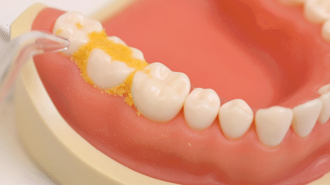 เครื่องล้างช่องปากที่แนะนำในปี 2568 : เครื่องล้างช่องปากยี่ห้อไหนดีที่สุด?