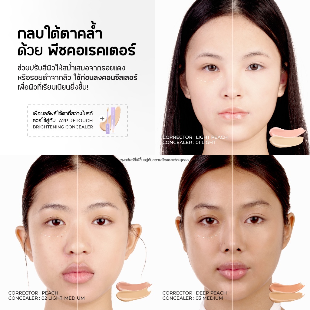 ✨ ทำไม “คอนซีลเลอร์” ถึงเป็นไอเท็มที่ขาดไม่ได้?