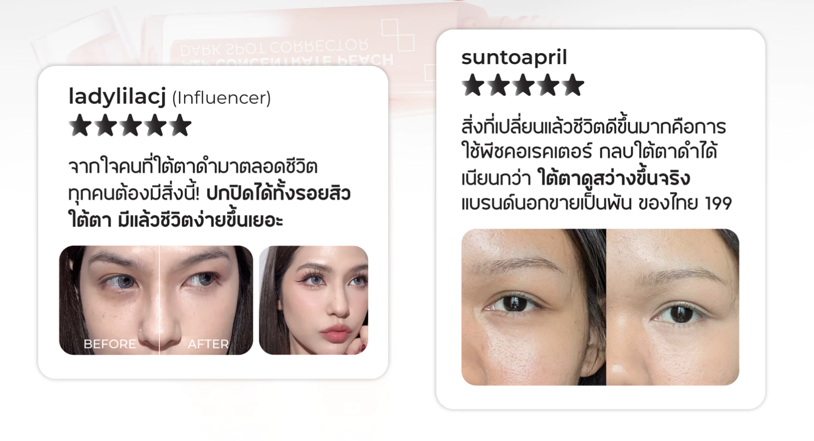 ✨ ทำไม “คอนซีลเลอร์” ถึงเป็นไอเท็มที่ขาดไม่ได้?