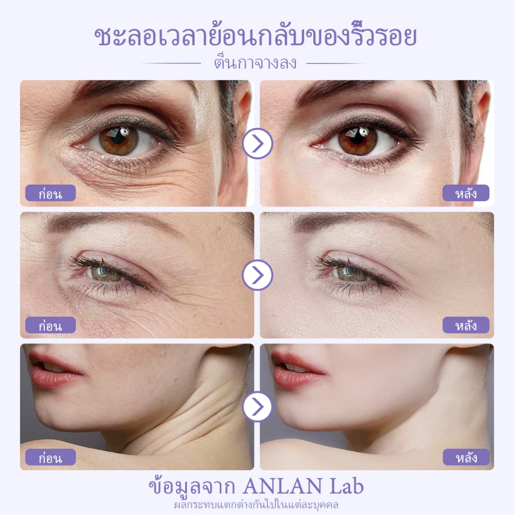 เครื่องนวดหน้ายกกระชับ ไอเทมลับสำหรับสาว ๆ