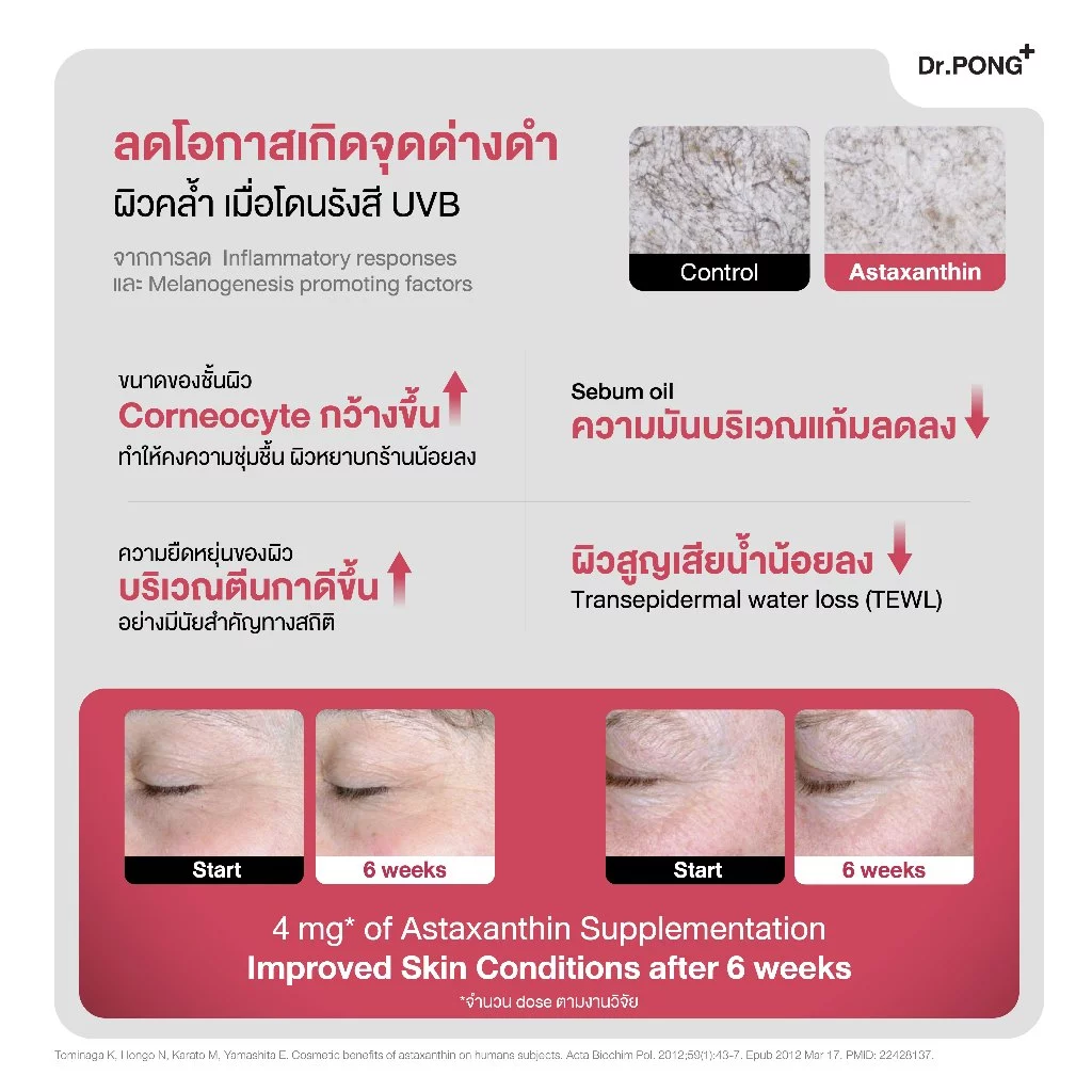Dr.PONG Astaxanthin 6 mg AstaREAL – อาหารเสริม “สายผิวใส + ต้านแก่” Image4