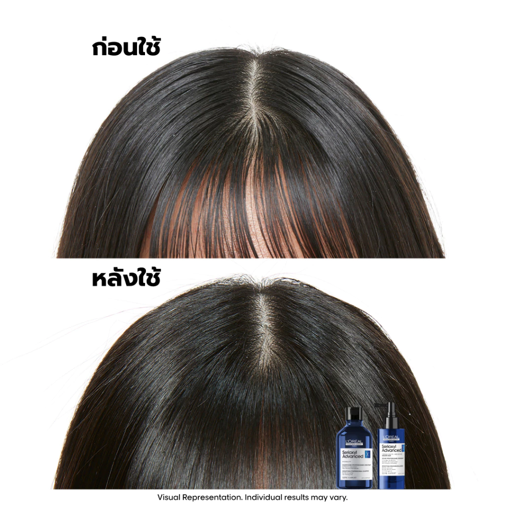 L’Oreal Professionnel Serioxyl Advanced Serum Image4