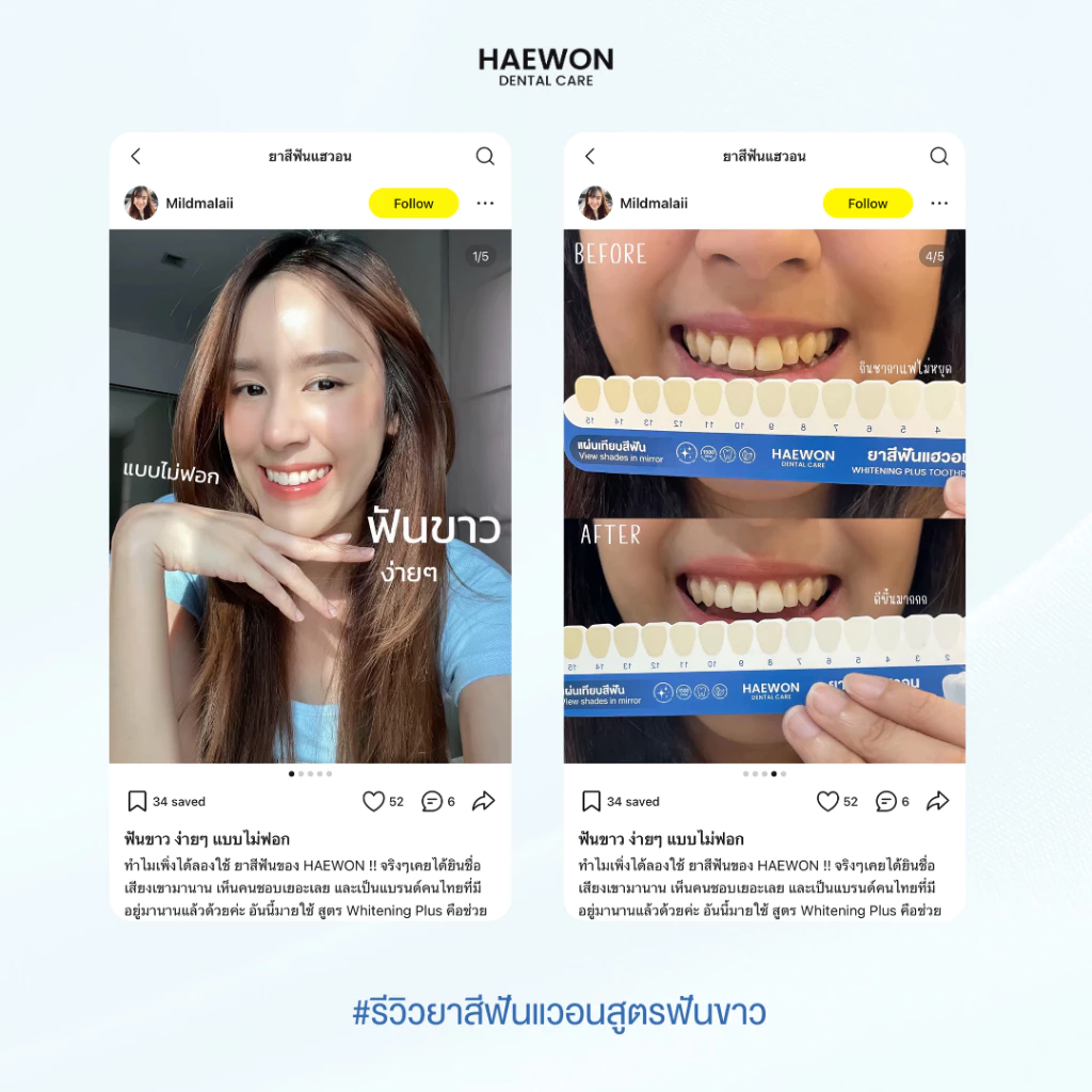 Haewon Whitening Plus ยาสีฟันสายฟันขาว สูตรใช้ง่าย ไม่ต้องฟอก Image3