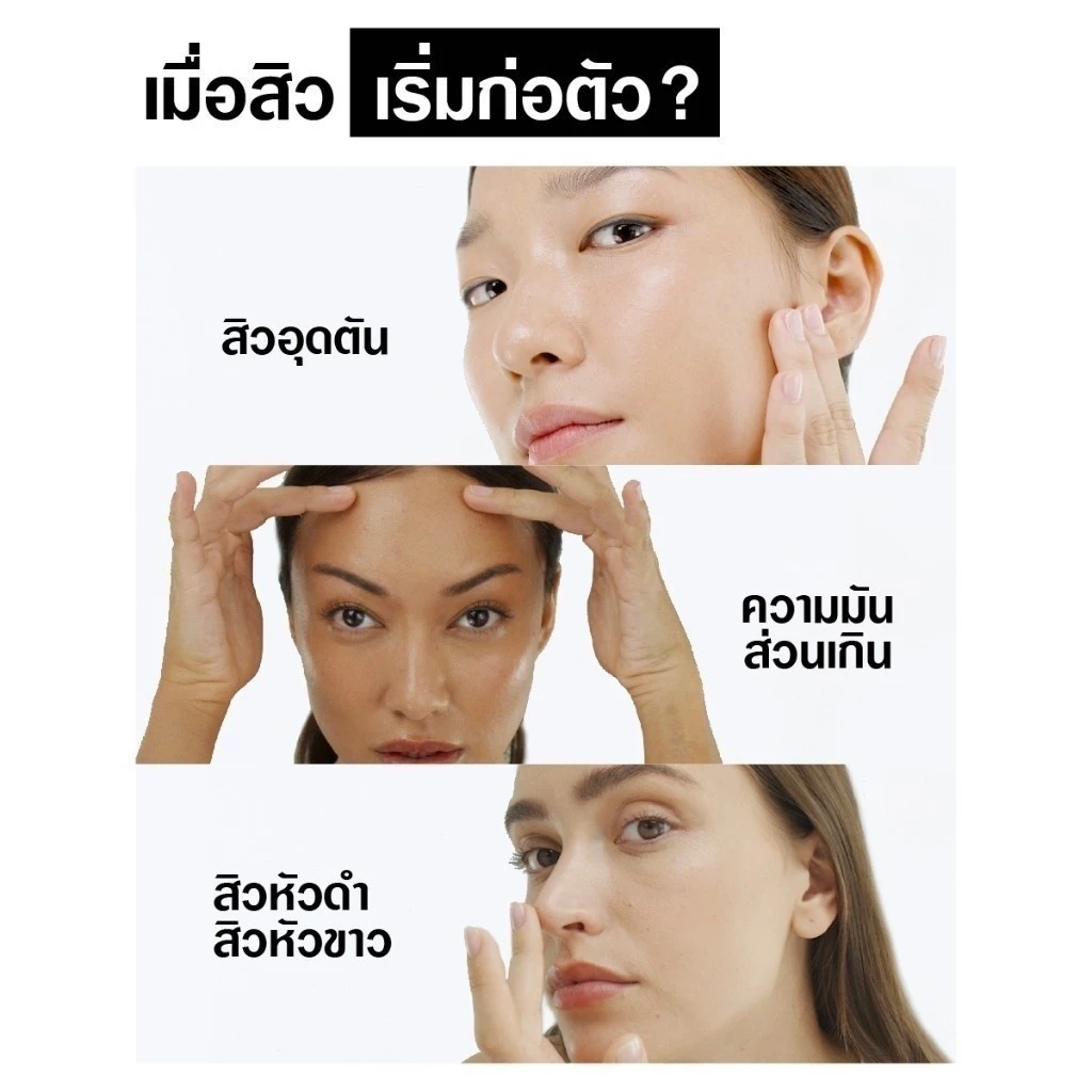 Neutrogena Deep Clean Acne Foaming Cleanser โฟมล้างหน้าสายล้างสะอาดลึก ลดสิว Image2