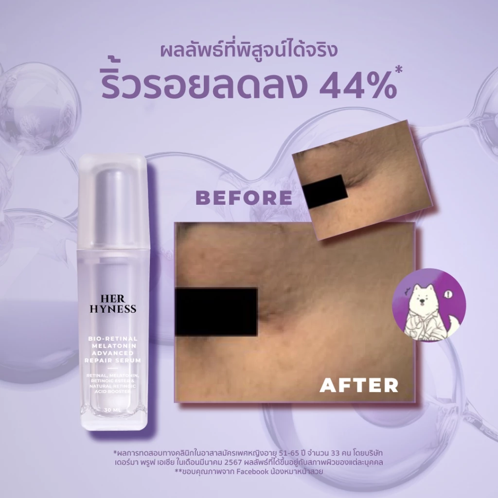 HER HYNESS Bio-Retinal Melatonin Advanced Repair Serum เซรั่มสายเรตินอลอ่อนโยน ฟื้นผิวตอนกลางคืน Image4