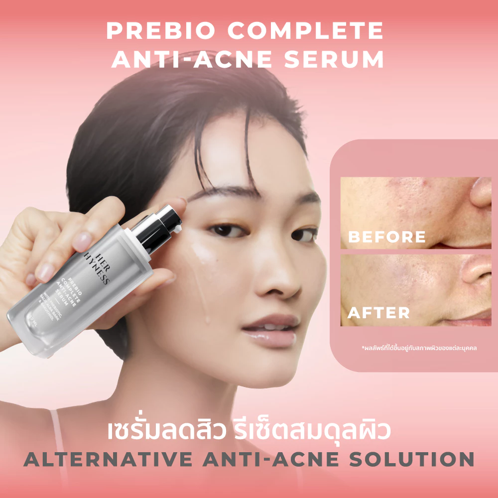 HER HYNESS Prebio Complete Anti-Acne Serum เซรั่มสิวสายอ่อนโยน เน้นบาลานซ์ผิวมากกว่าฆ่าสิวแรง Image1