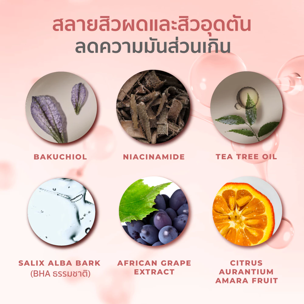 HER HYNESS Prebio Complete Anti-Acne Serum เซรั่มสิวสายอ่อนโยน เน้นบาลานซ์ผิวมากกว่าฆ่าสิวแรง Image5