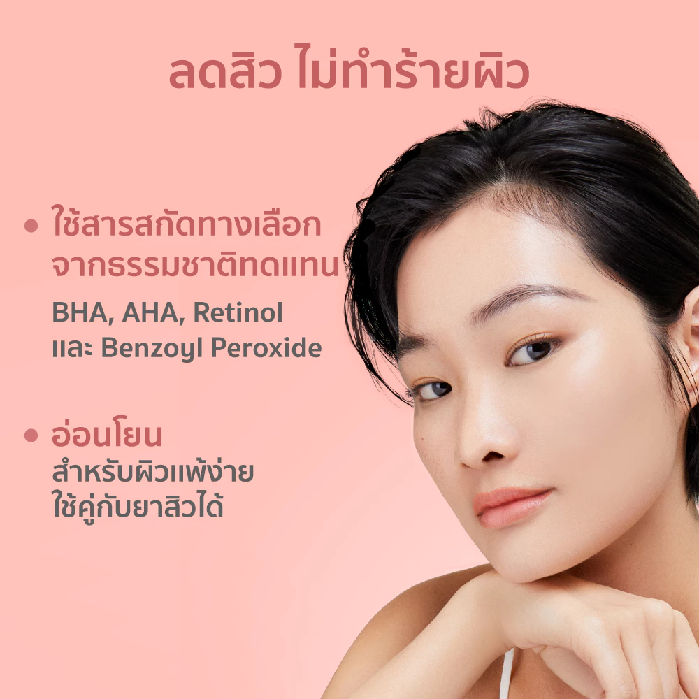 HER HYNESS Prebio Complete Anti-Acne Serum เซรั่มสิวสายอ่อนโยน เน้นบาลานซ์ผิวมากกว่าฆ่าสิวแรง Image3