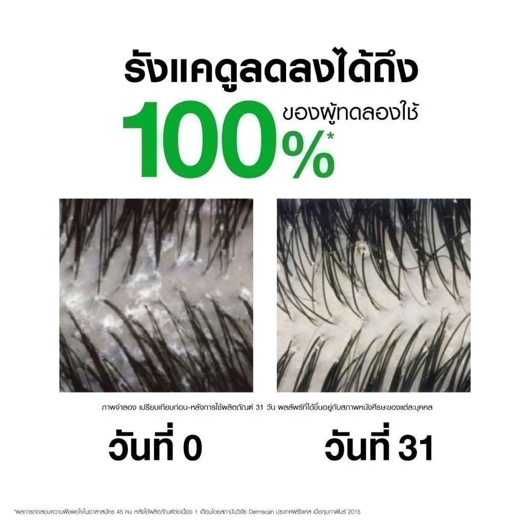 VICHY Dercos Anti-Dandruff Shampoo แชมพูขจัดรังแค ลดคัน ดูแลหนังศีรษะจริงจัง Image4