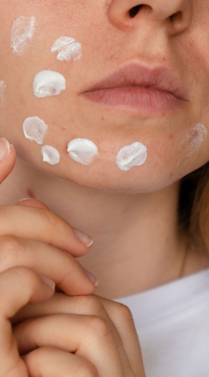 สิวขึ้นที่คาง แค่ผิวไม่ดี…หรือร่างกายกำลังบอกอะไรบางอย่าง? Image1