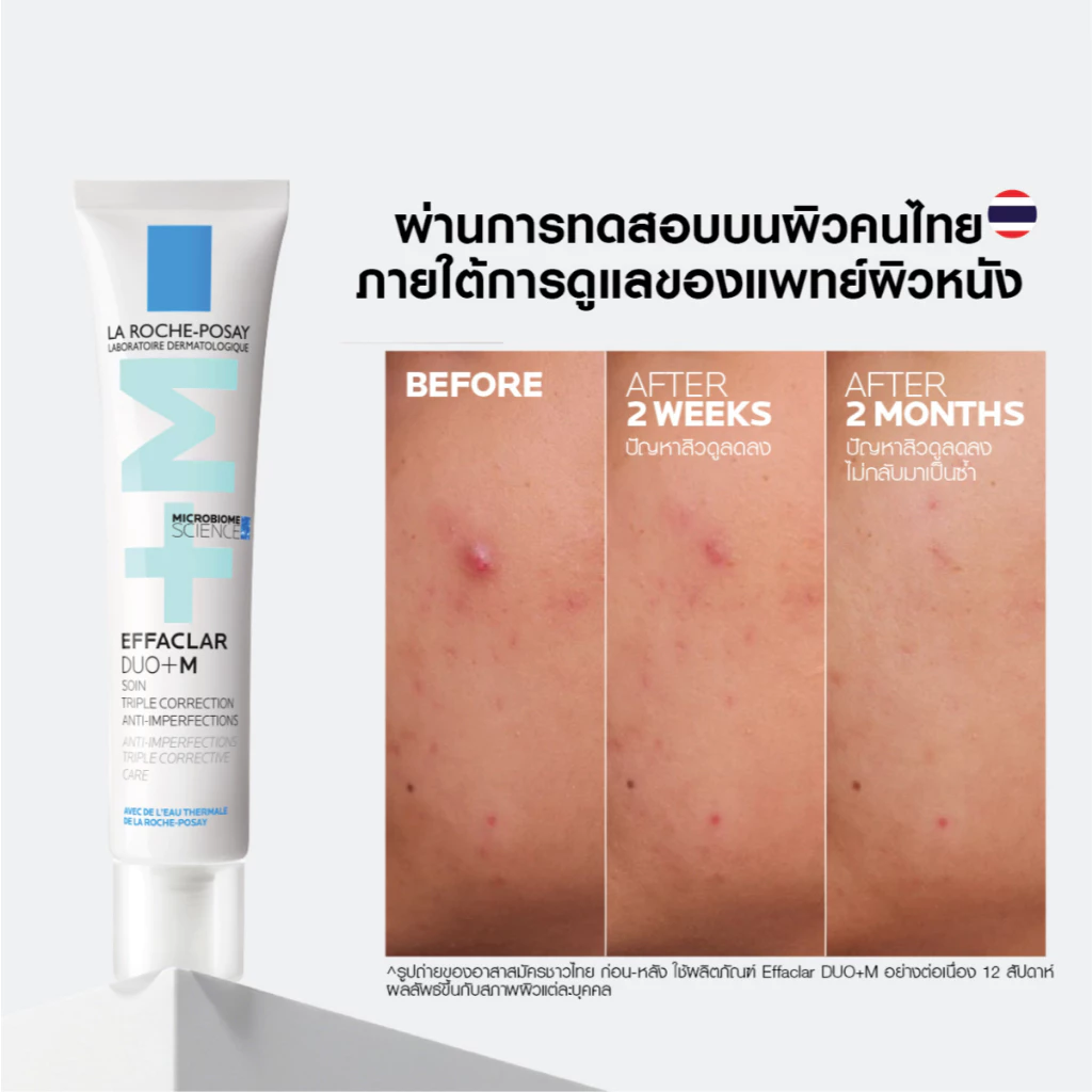 La Roche-Posay Effaclar Duo+M ครีมลดสิว เน้นเคลียร์รูขุมขน + คุมมัน ใช้ได้ทุกวัน Image3