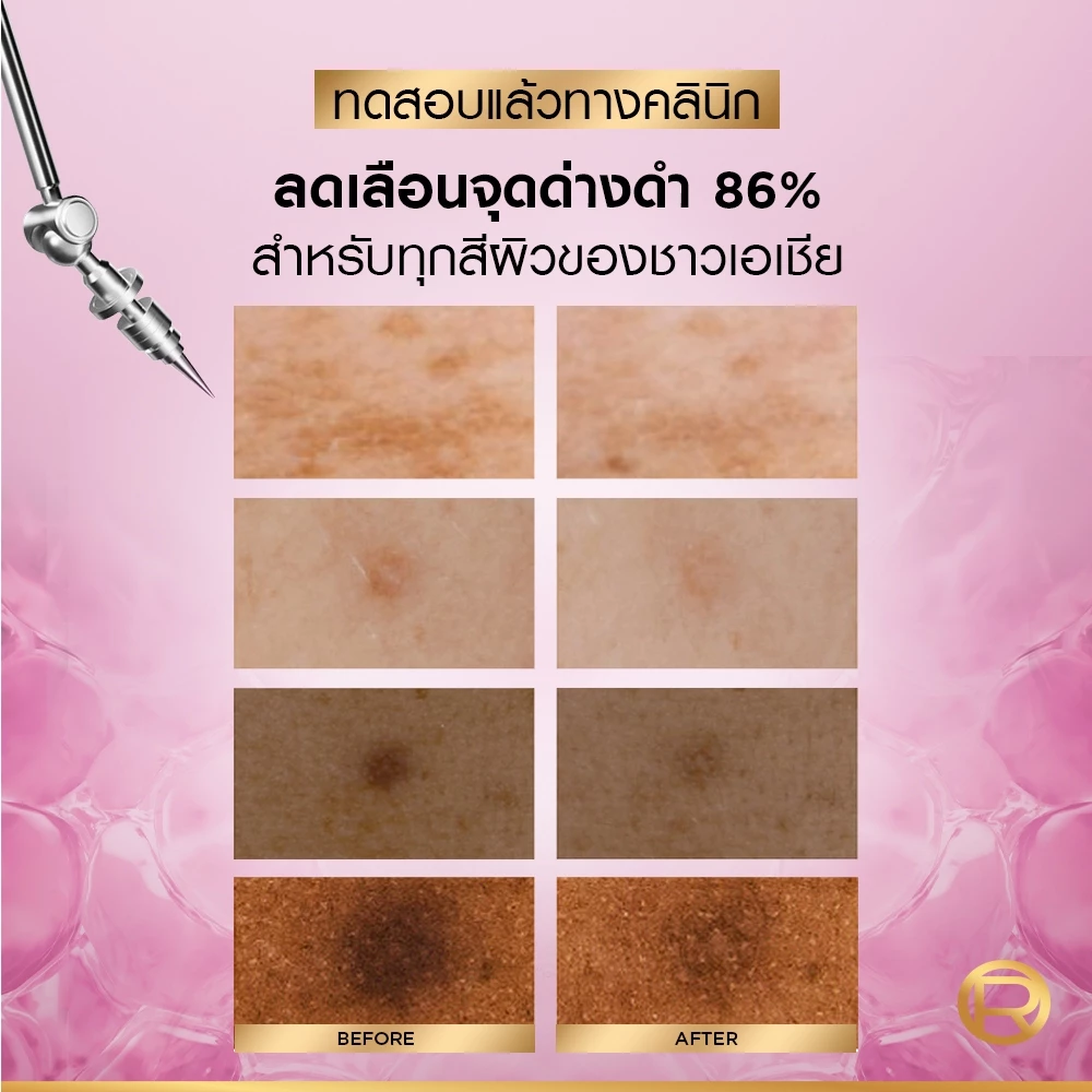 L’Oréal Glycolic Bright Set เซ็ตสายลดรอยดำ ผิวใส เน้นผลัดผิว + ปรับสีผิวให้สม่ำเสมอ Image3