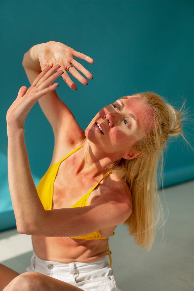 ผิวไหม้แดด…ไม่ใช่แค่แสบ แต่คือสัญญาณเตือนที่หลายคนมองข้าม Image1