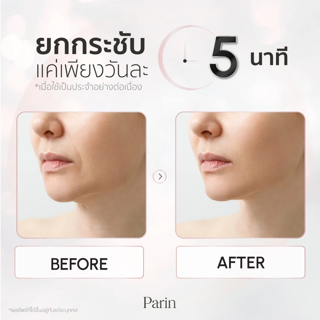 Parin RE-YOUTH เครื่องนวดยกกระชับผิว สาย beauty gadget ทำเองที่บ้าน ได้ฟีลคลินิก Image3