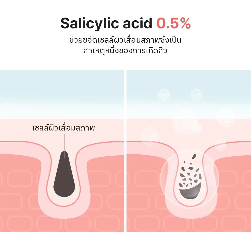 COSRX Salicylic Acid Cleanser โฟมล้างหน้าลดสิว คุมมัน ลดอุดตัน Image2