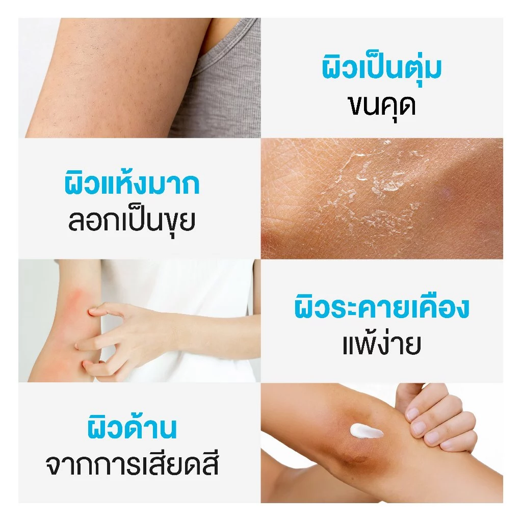 Dr.PONG U9.9 ครีมกู้ผิวแห้งที่คนขนคุดชอบมาก Image4