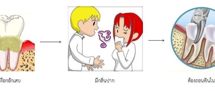 ยาสีฟันคอลเกตกับการดูแลคราบหินปูน