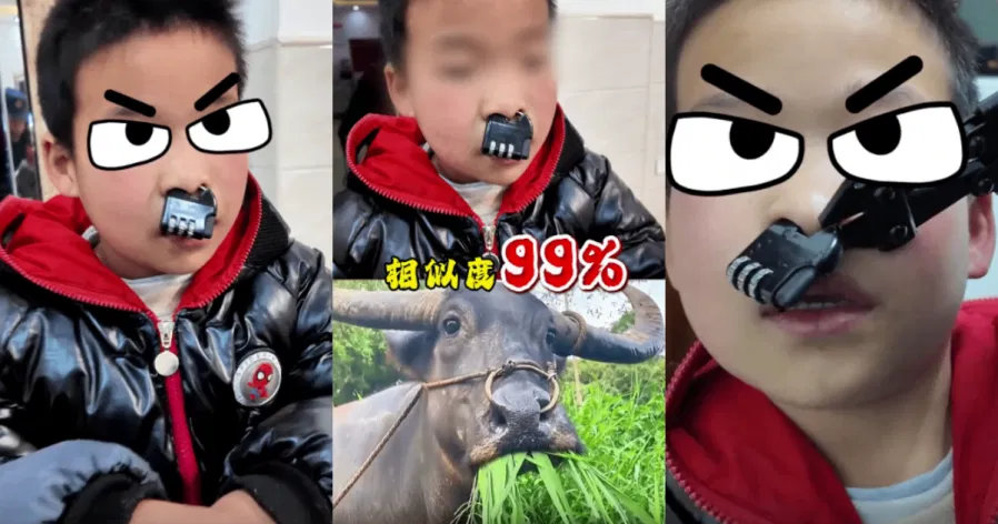 เด็กชายเอาแม่กุญแจคล้องจมูกตัวเอง สุดท้ายต้องให้เจ้าหน้าที่ช่วยตัดออก Image2