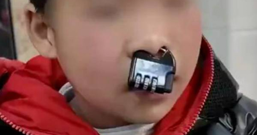เด็กชายเอาแม่กุญแจคล้องจมูกตัวเอง สุดท้ายต้องให้เจ้าหน้าที่ช่วยตัดออก Image1