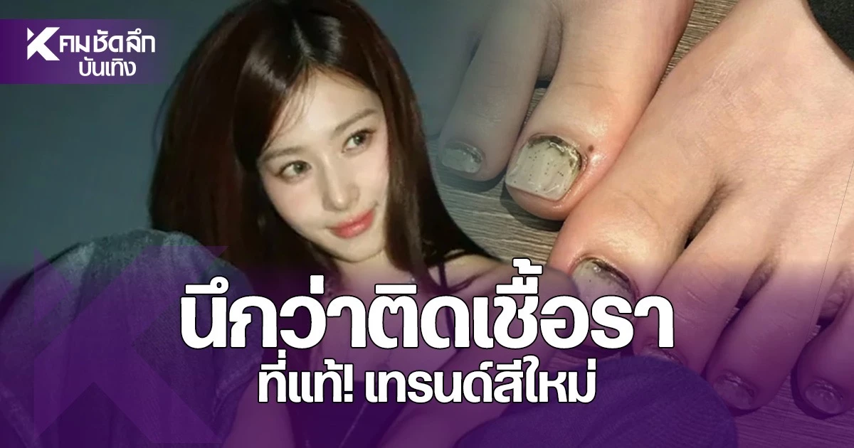 เล็บเท้าสีเขียว: จากความเข้าใจผิดเรื่องเชื้อรา สู่เทรนด์แฟชั่น Dirty Nails