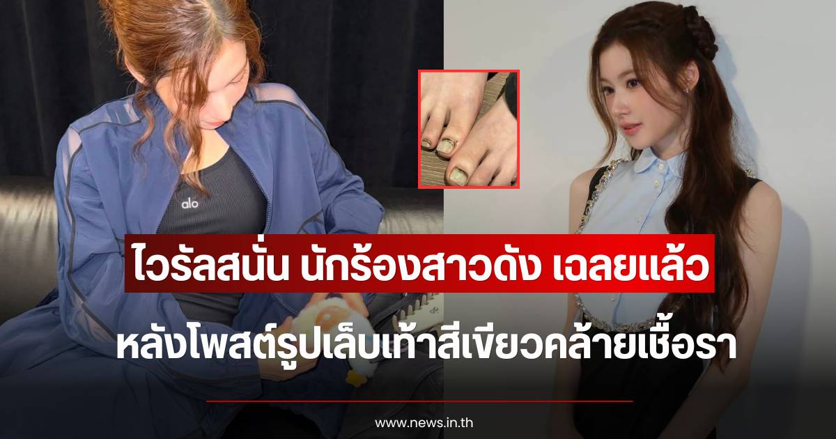 เล็บเท้าสีเขียว: จากความเข้าใจผิดเรื่องเชื้อรา สู่เทรนด์แฟชั่น Dirty Nails