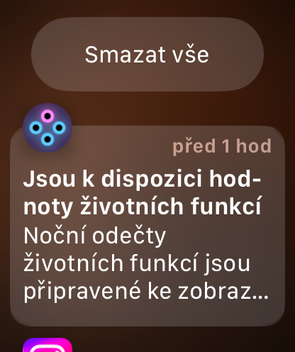 ตรวจจับการล้ม Apple Watch: เมื่อสมาร์ทวอทช์กลายเป็นฮีโร่เงียบในบ้าน