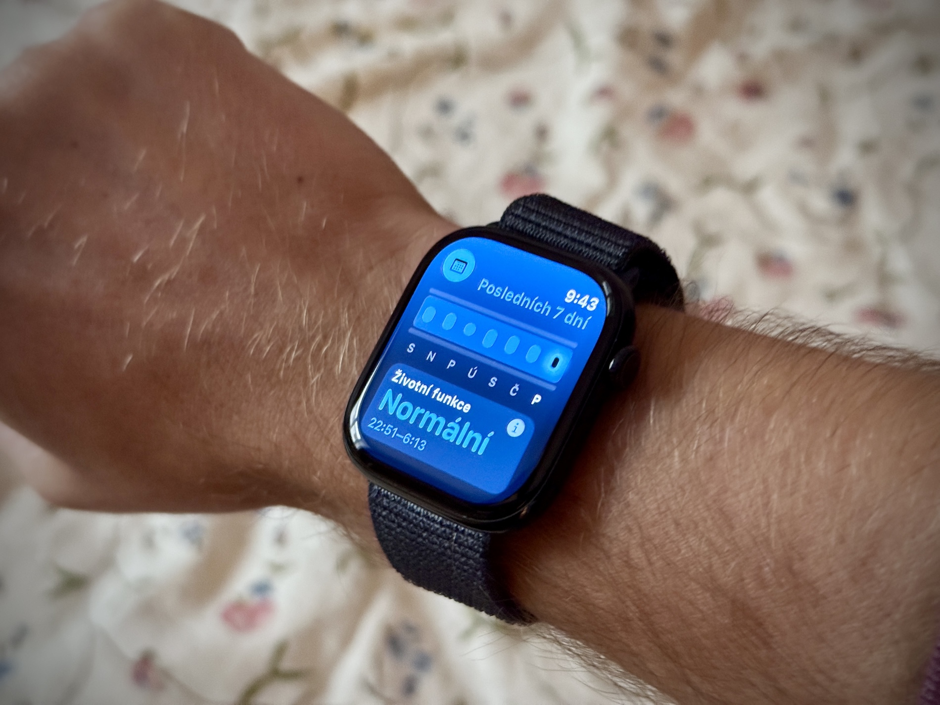 ตรวจจับการล้ม Apple Watch: เมื่อสมาร์ทวอทช์กลายเป็นฮีโร่เงียบในบ้าน
