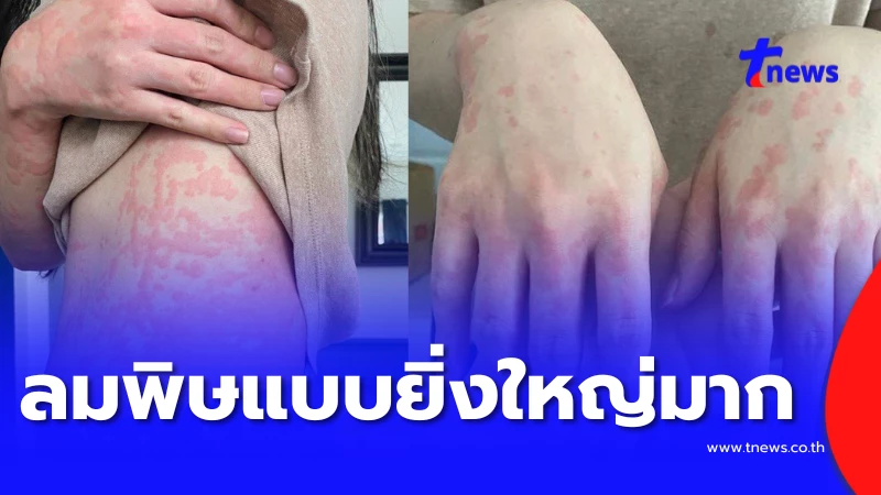 แค่เหนื่อยหรือนอนผิดปกติ สัญญาณเตือนที่ร่างกายไม่เคยโกหก
