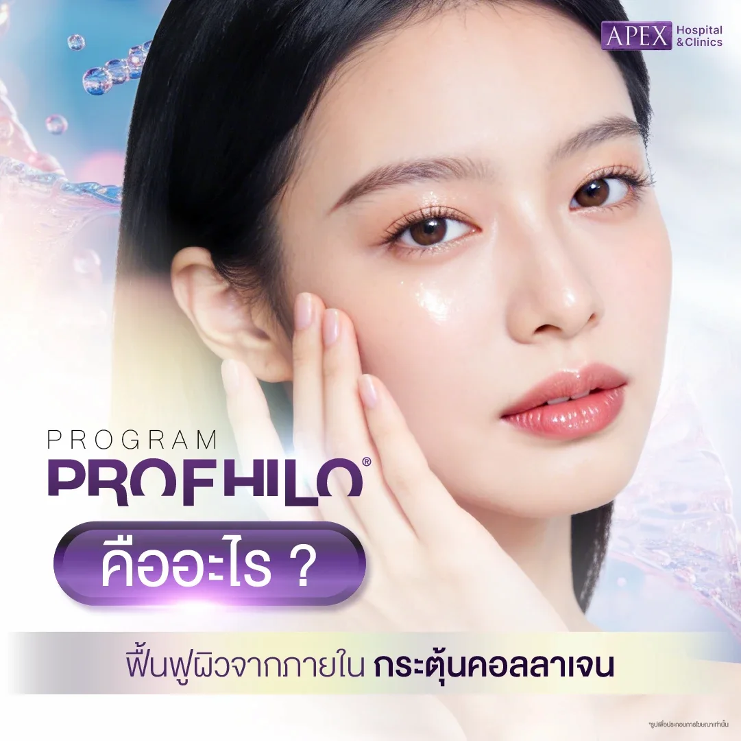 ฟิลเลอร์ไฮยาลูโรนิกแอซิดแบบฉีด เลือก Teoxane หรือ Profhilo ดีสุดสำหรับคุณ