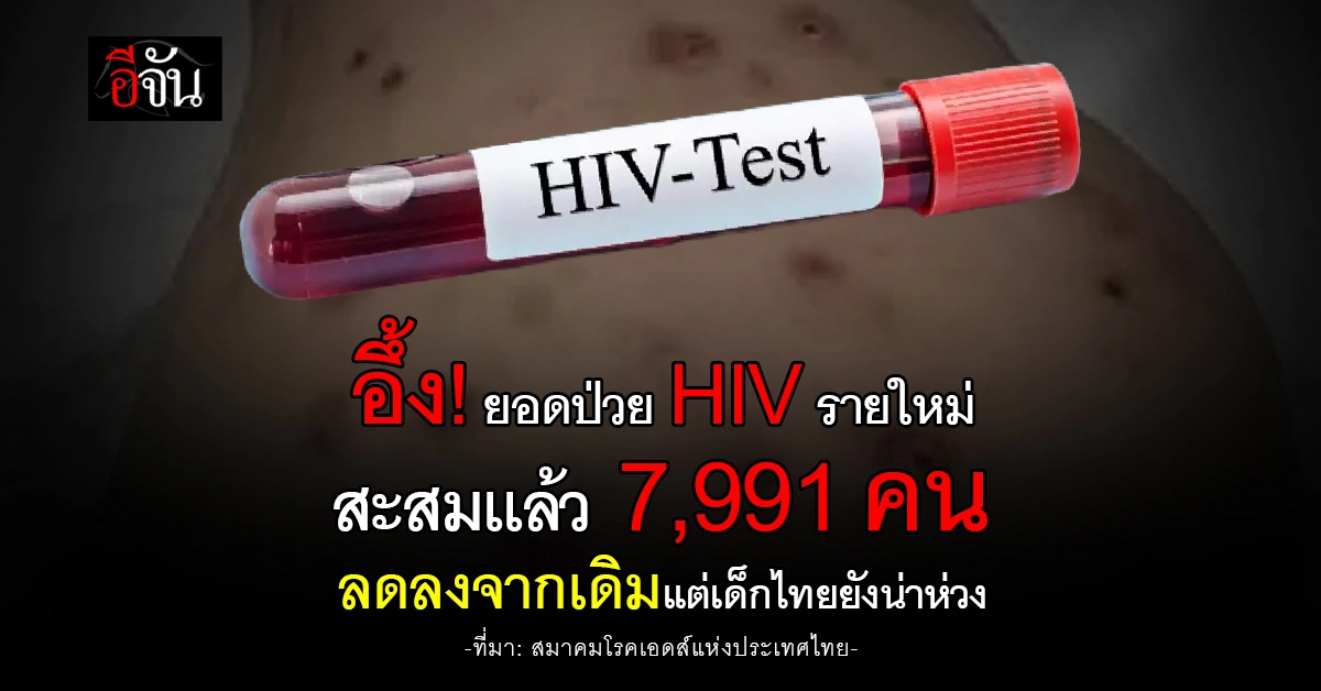 การตรวจ HIV คือการดูแลตัวเองและครอบครัว ไม่ใช่เรื่องน่าอาย