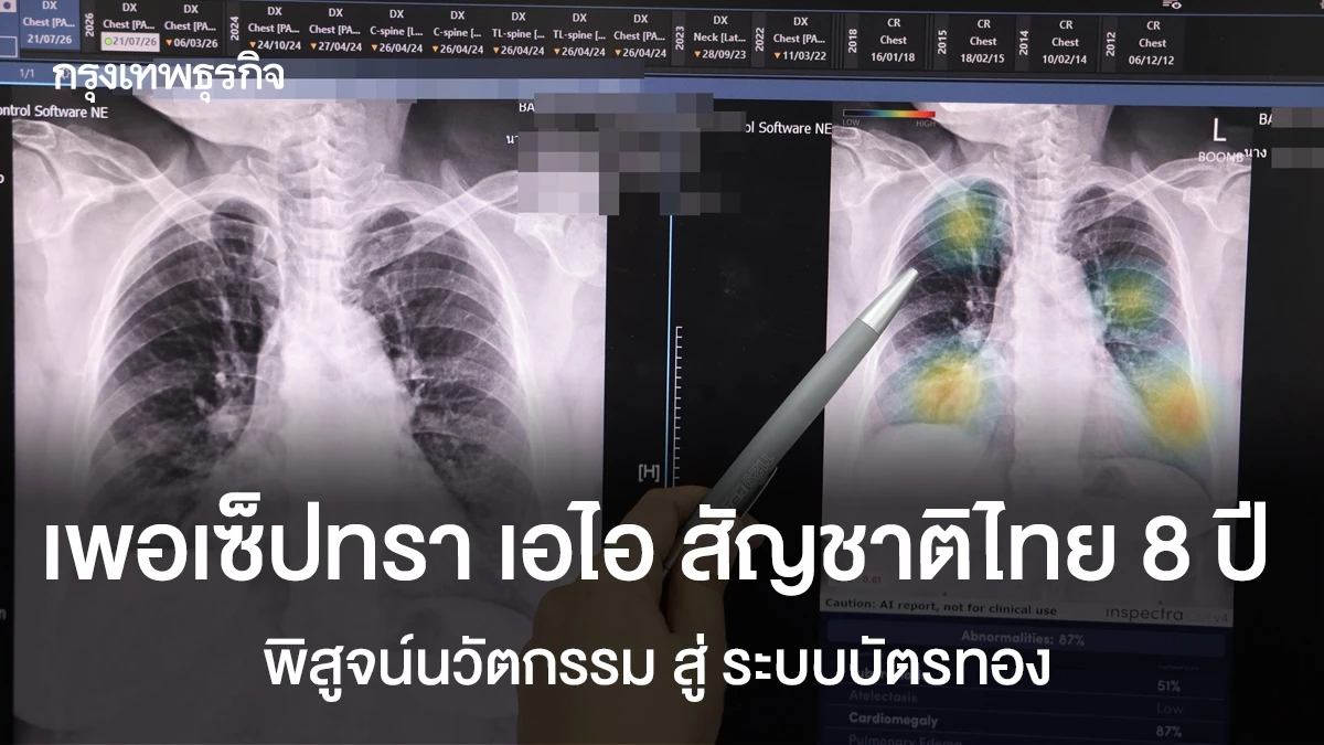 เมื่อ AI พบแพทย์: ความเชื่อใจสำคัญกว่าความแม่นยำ