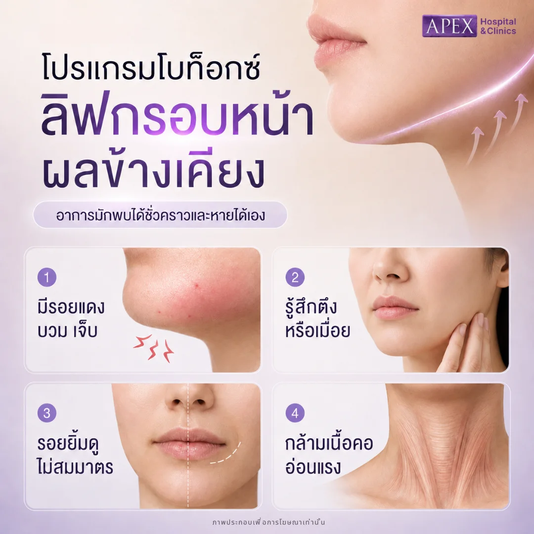 ผลข้างเคียงโบท็อก แยกอาการธรรมดาและสัญญาณอันตรายที่ต้องรู้