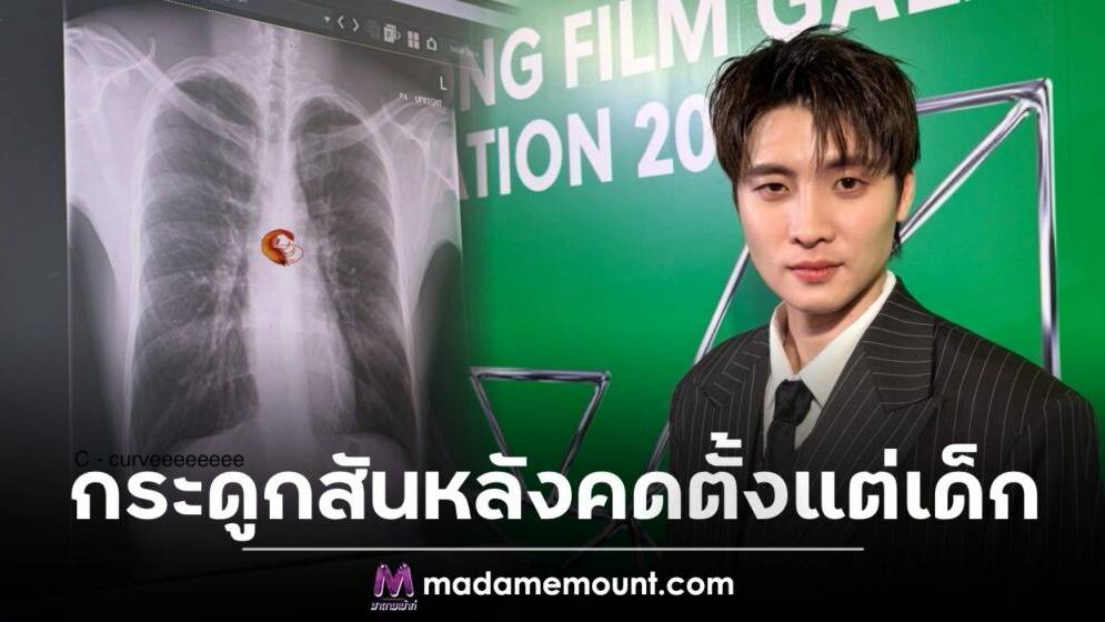 ทำไมคนรุ่นใหม่ข้อพังเร็ว: ราคาที่ต้องจ่ายจากกระแสรักสุขภาพสุดโต่ง