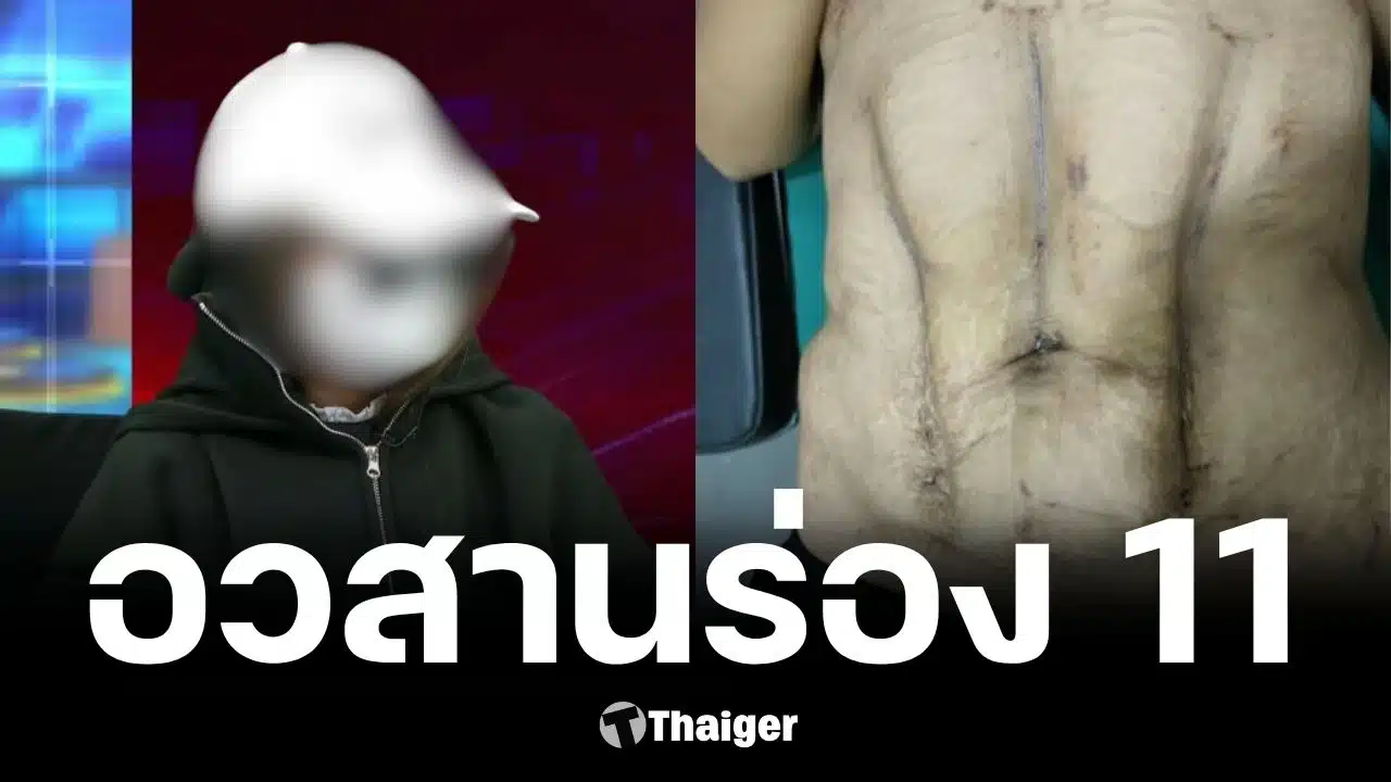 เมื่อศัลยกรรมเสริมความงามพลาด คู่มือเรียกร้องค่าเสียหายอย่างไม่ยอมถูกเอาเปรียบ