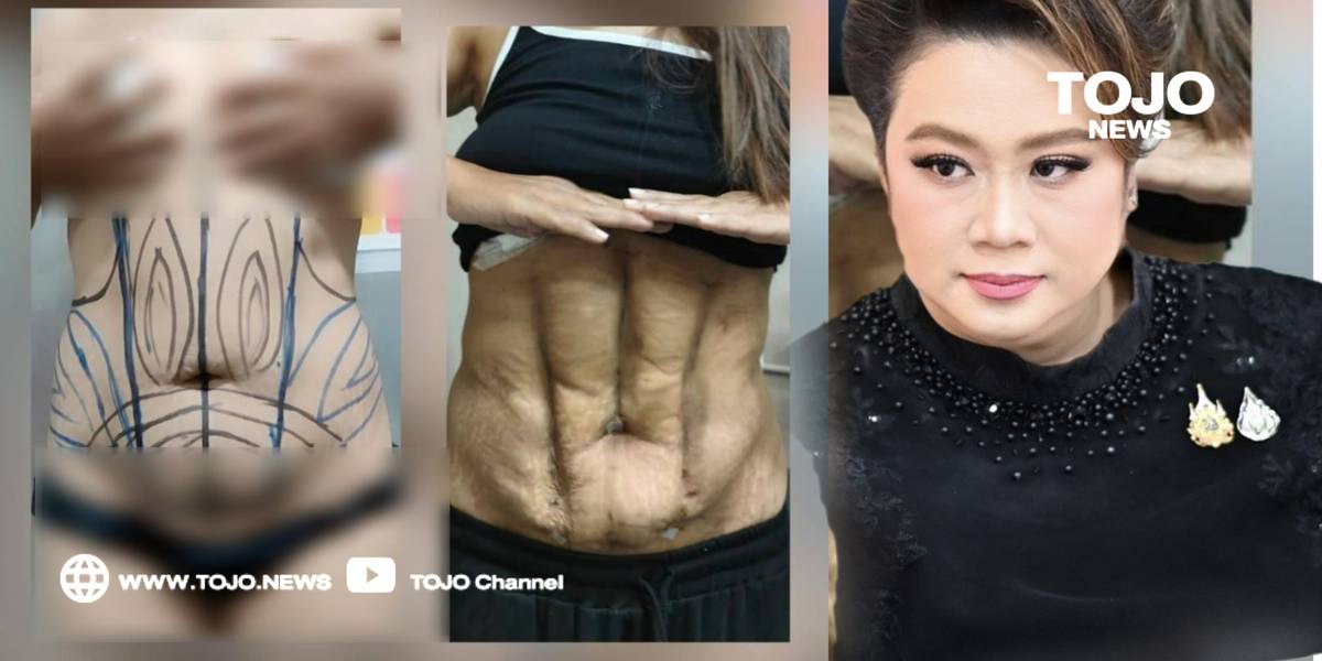 ศัลยกรรมเสริมสวยถูกเพ่งเล็ง รัฐเดินเกมเข้มสกัดโฆษณาเท็จและราคาไม่โปร่งใส