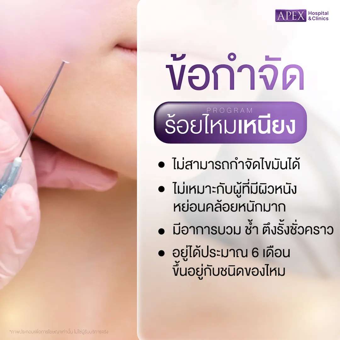 ร้อยไหมกับ HIFU: เทคนิคยกกระชับไหนเหมาะกับผิวคุณมากกว่า