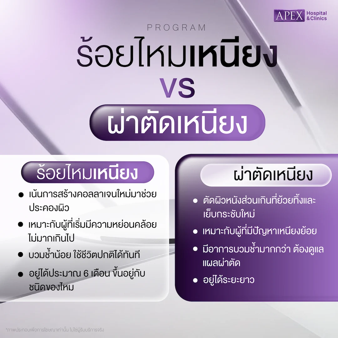 ร้อยไหมกับ HIFU: เทคนิคยกกระชับไหนเหมาะกับผิวคุณมากกว่า