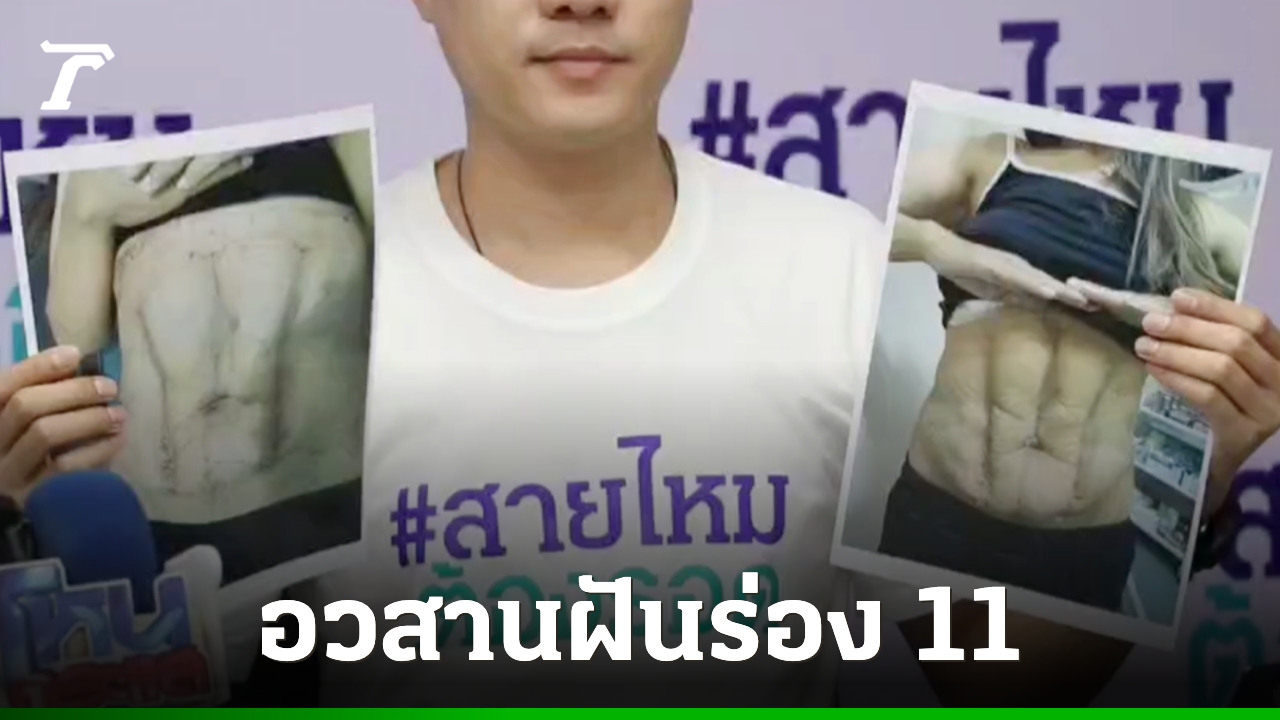 เมื่อศัลยกรรมเสริมความงามผิดพลาด สิทธิและทางออกของผู้บริโภค