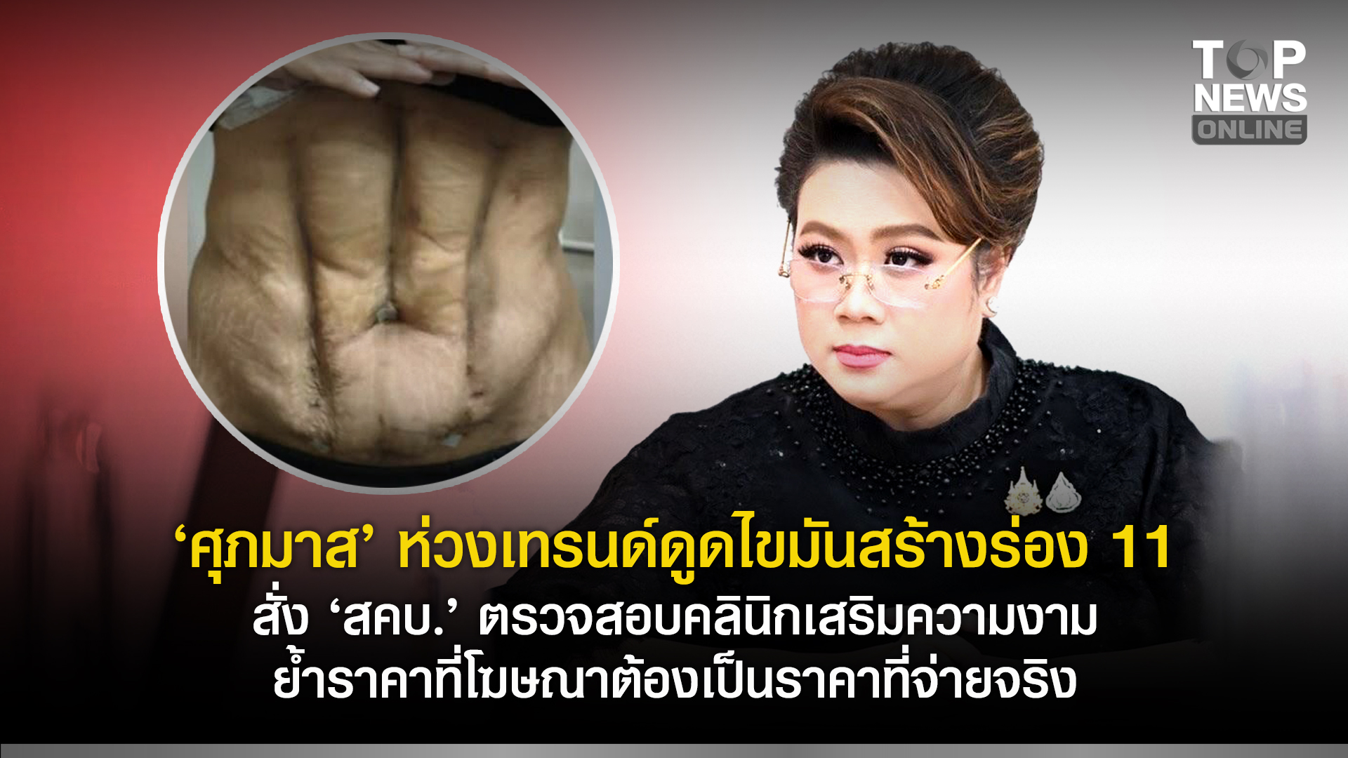ภาครัฐเข้มคลินิกเสริมความงาม: ราคาชัด หมอชัด ปลอดภัยต้องชัด