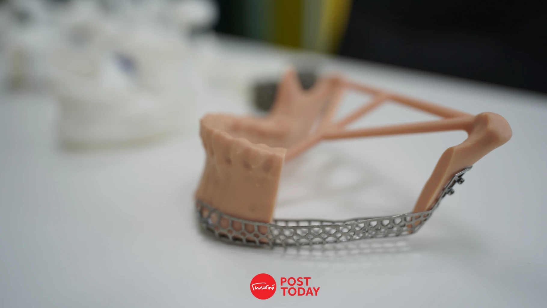AI 3D Printing พลิกเกมผลิตอุปกรณ์แพทย์เฉพาะบุคคล