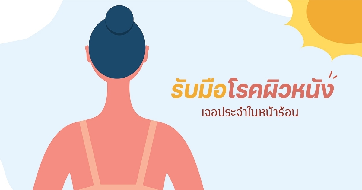 เหงื่อและความร้อนทำให้ผิวแพ้ วิธีป้องกันและรักษาผื่นคัน