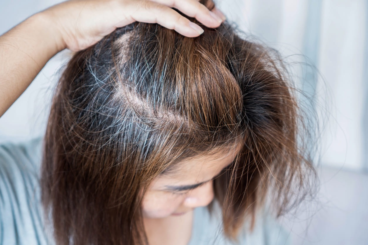 10-Year Hair Blueprint วางแผนผมหนา สุขภาพดีตั้งแต่วันนี้