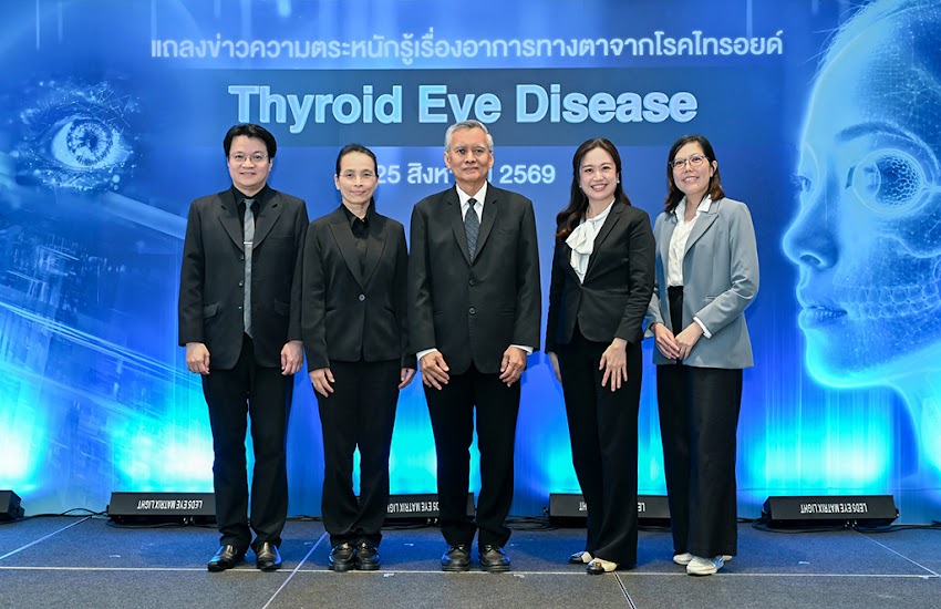 โรคไทรอยด์ขึ้นตา สัญญาณลับที่เริ่มจากการมองเห็นผิดปกติ