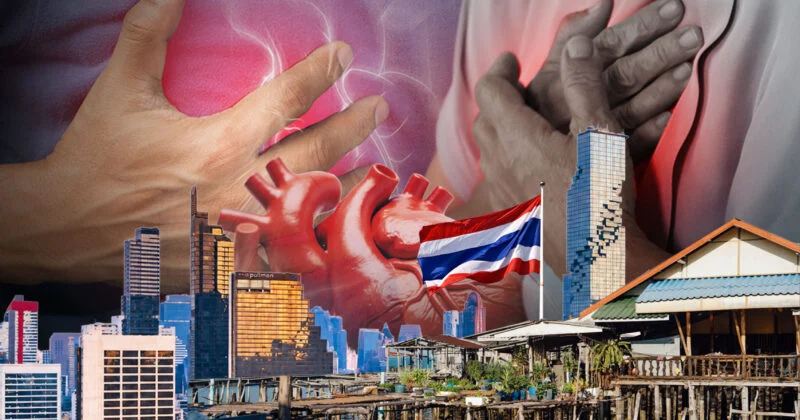 ภาวะหัวใจห้องบนสั่นพลิ้ว โรคเงียบที่ต้องรีบตรวจจับ