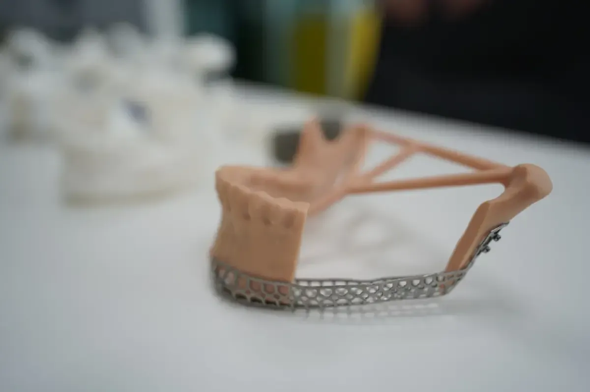 3D Printing ศัลยกรรม จากแบบจำลองกระดูกถึงกายอุปกรณ์เฉพาะคน